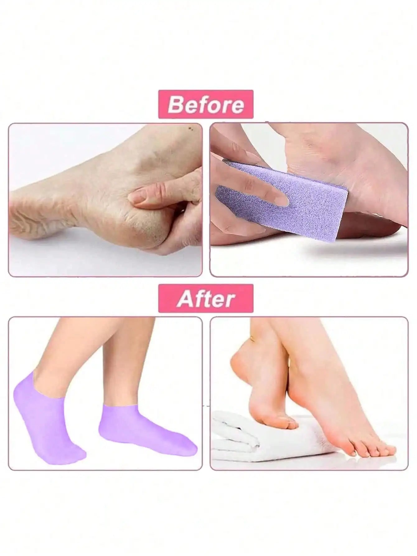 Silicone Gel Moisturizing Socks, Prevent Cracking